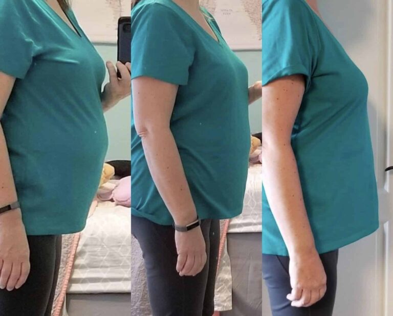 CryoSlim after 3 Sessions